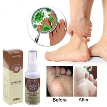 Sprej protiv gljivica na stopalima (1+1 GRATIS)